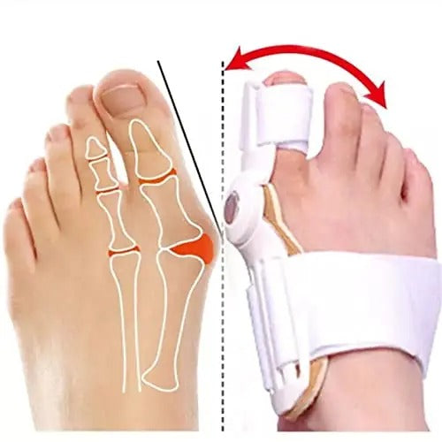 Thumb Valgus Toe Corrector